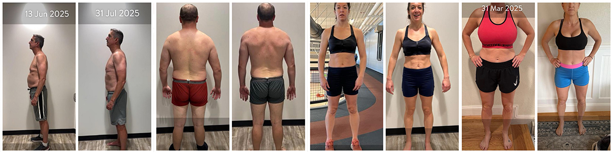 Core Progression Results Before and After Image